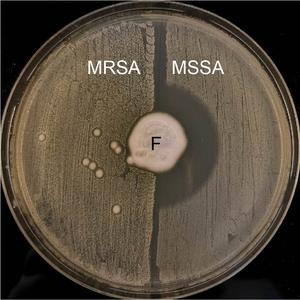 alt: Petriho miska s agarem, na kterém roste houba (F) produkující antibiotikum. Na levé polovině misky rostou bakterie rezistentní na antibiotikum (MRSA), na pravé polovině misky jsou citlivé bakterie (MSSA) - antibiotikum produkované houbou je zabíjí a vytváří čistý půlkruh vpravo uprostřed. Foto Claire L. Raisen